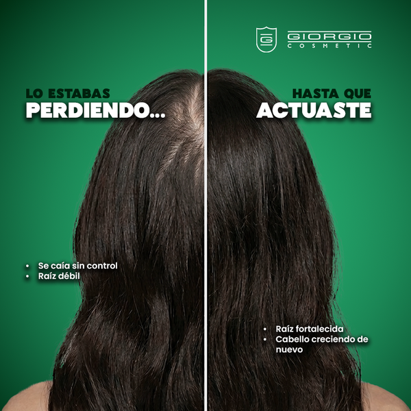 Tonico Capilar 120 ml Giorgio